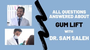 Gum Lift Questions