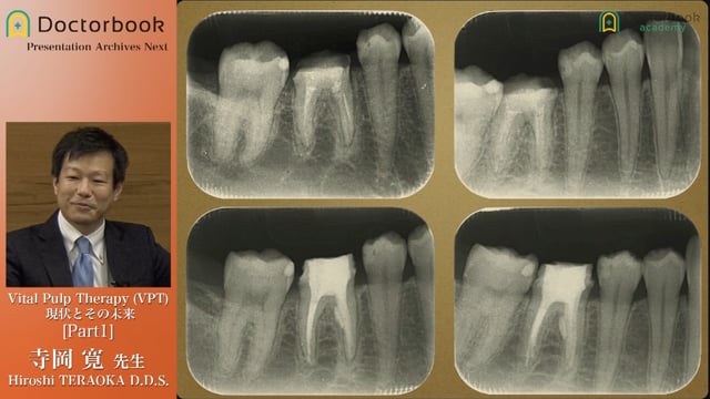 Vital Pulp Therapy(VPT) 現状とその未来