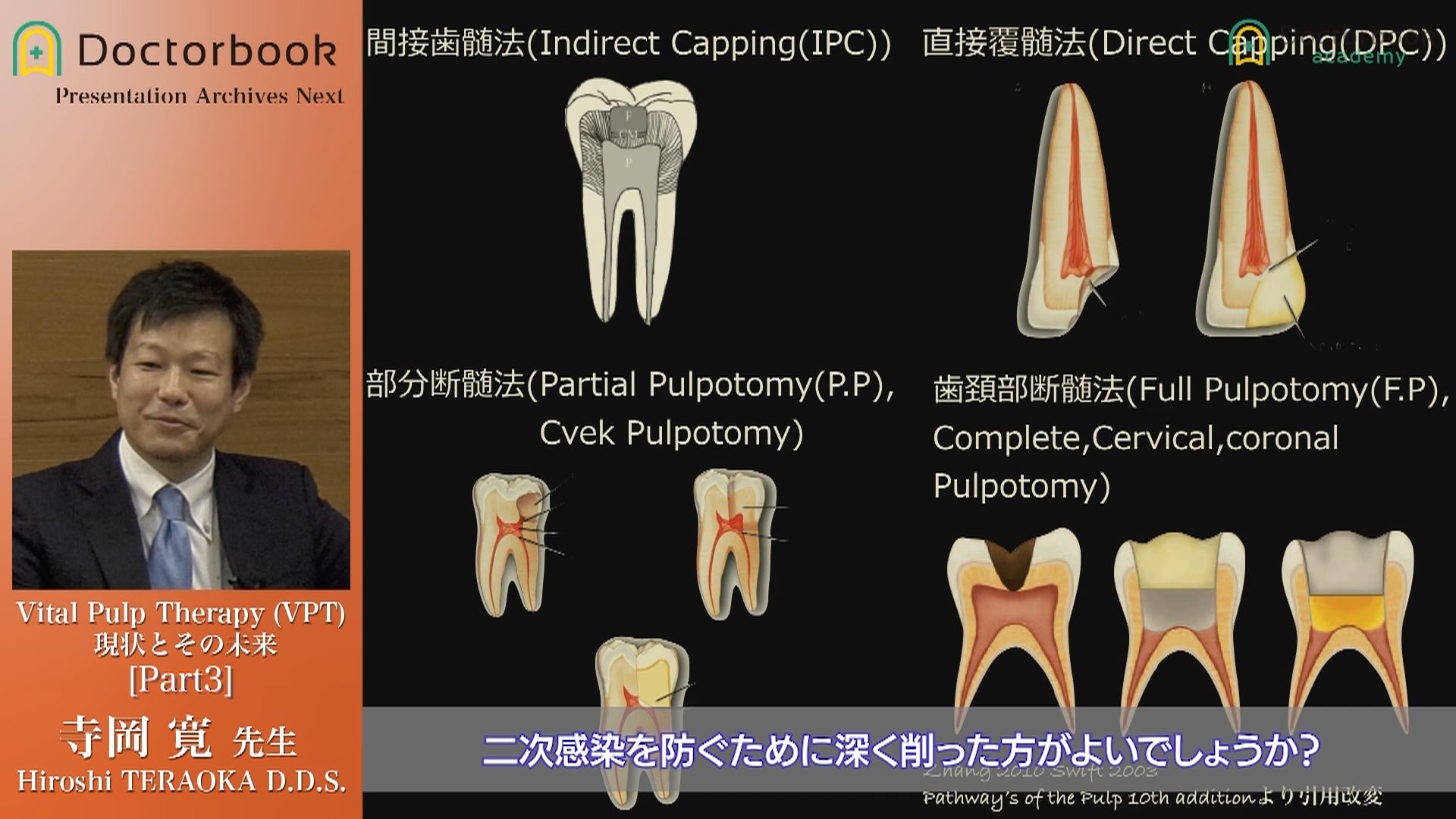 #3 VPTの統計