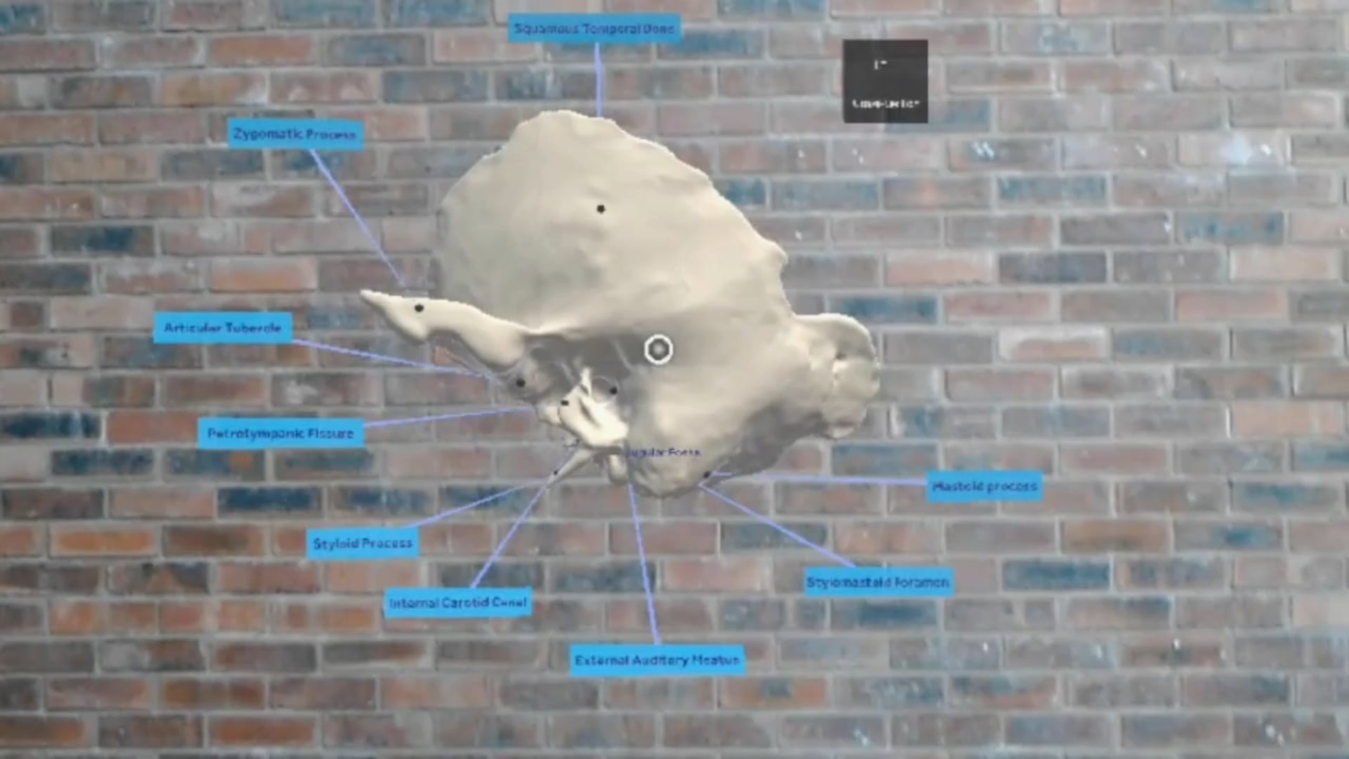 Temporal Bone Anatomy - Augmented Reality Demonstration