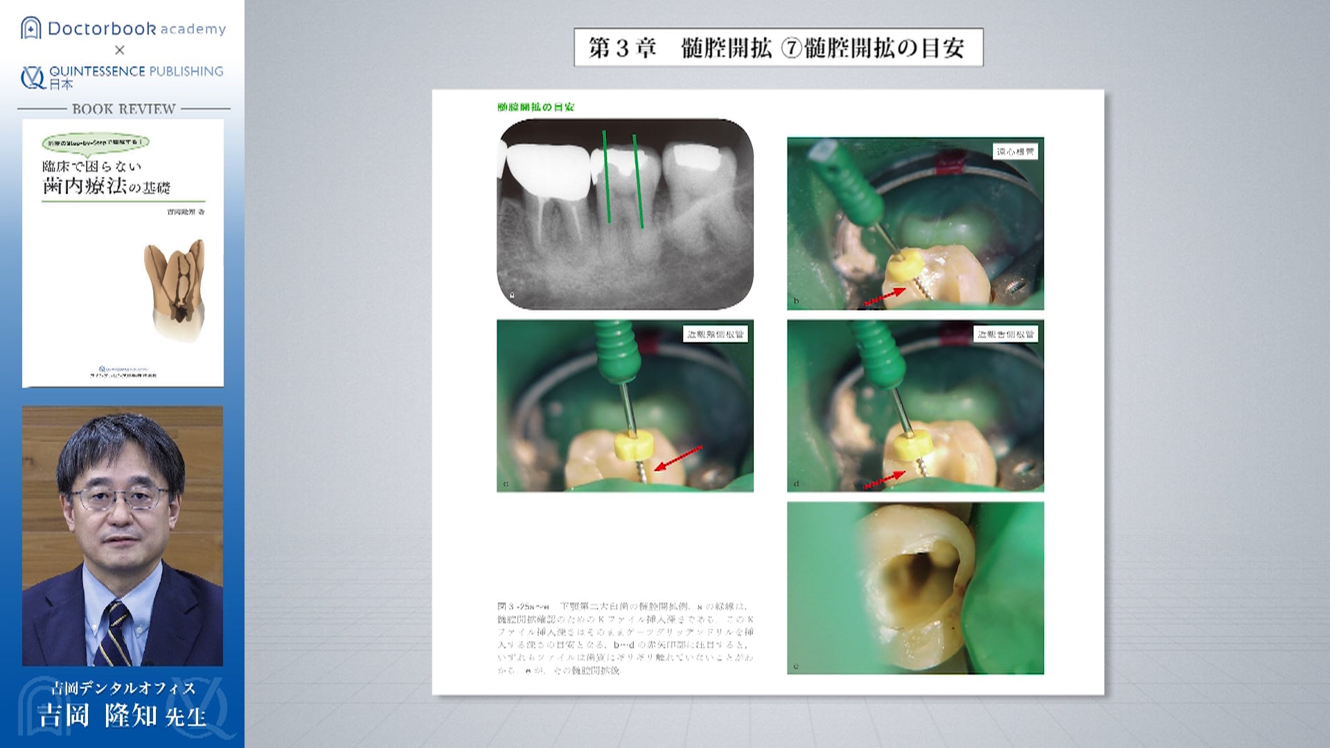 【Book Rev.】臨床で困らない歯内療法の基礎 | Doctorbook academy (ドクターブックアカデミー)