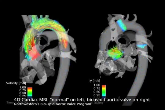 4D flow on Vimeo