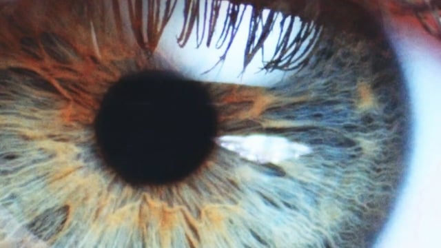 vimeo thumbnail