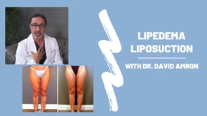 Lipedema Lipo Procedure with Dr. Amron