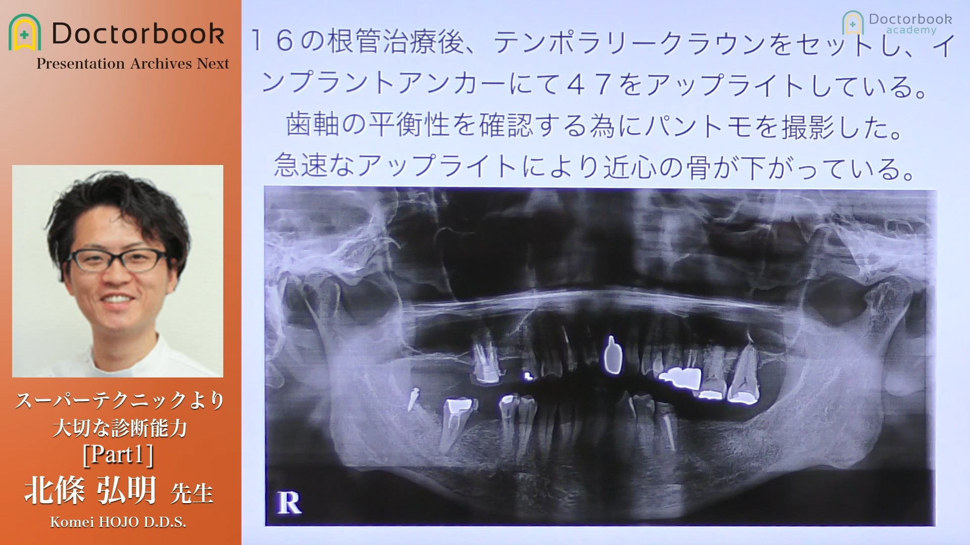 #1 診断