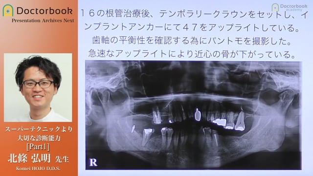 スーパーテクニックより大切な診断能力