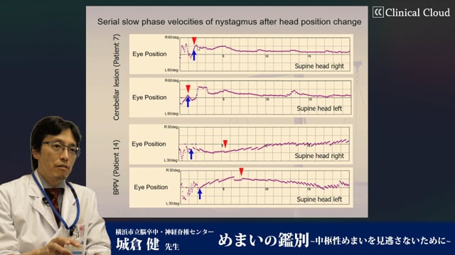 知っておきたい！日常診療でのめまい診断と治療の手引き Part3