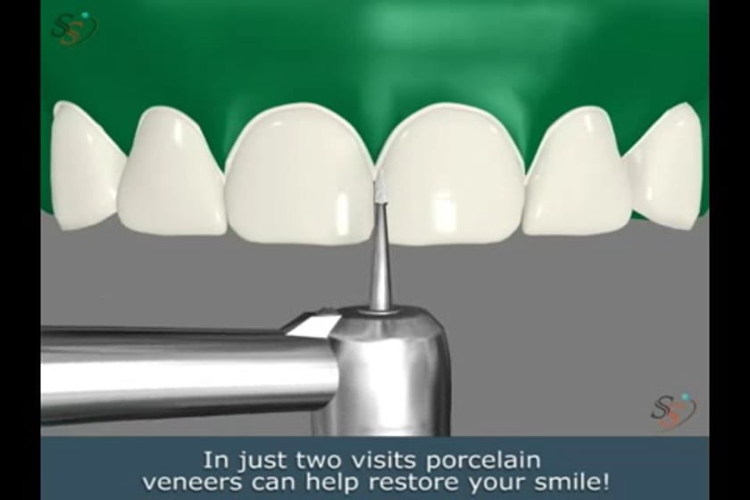 vimeo-video-thumbnail