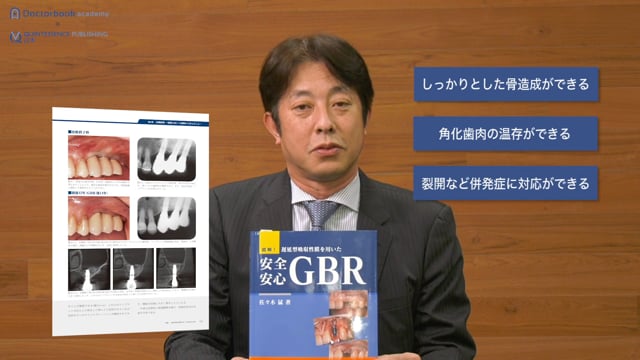 【Book Rev.】図解！ 遅延型吸収性膜を用いた 安全安心GBR