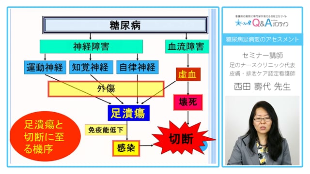 糖尿病足病変のアセスメント