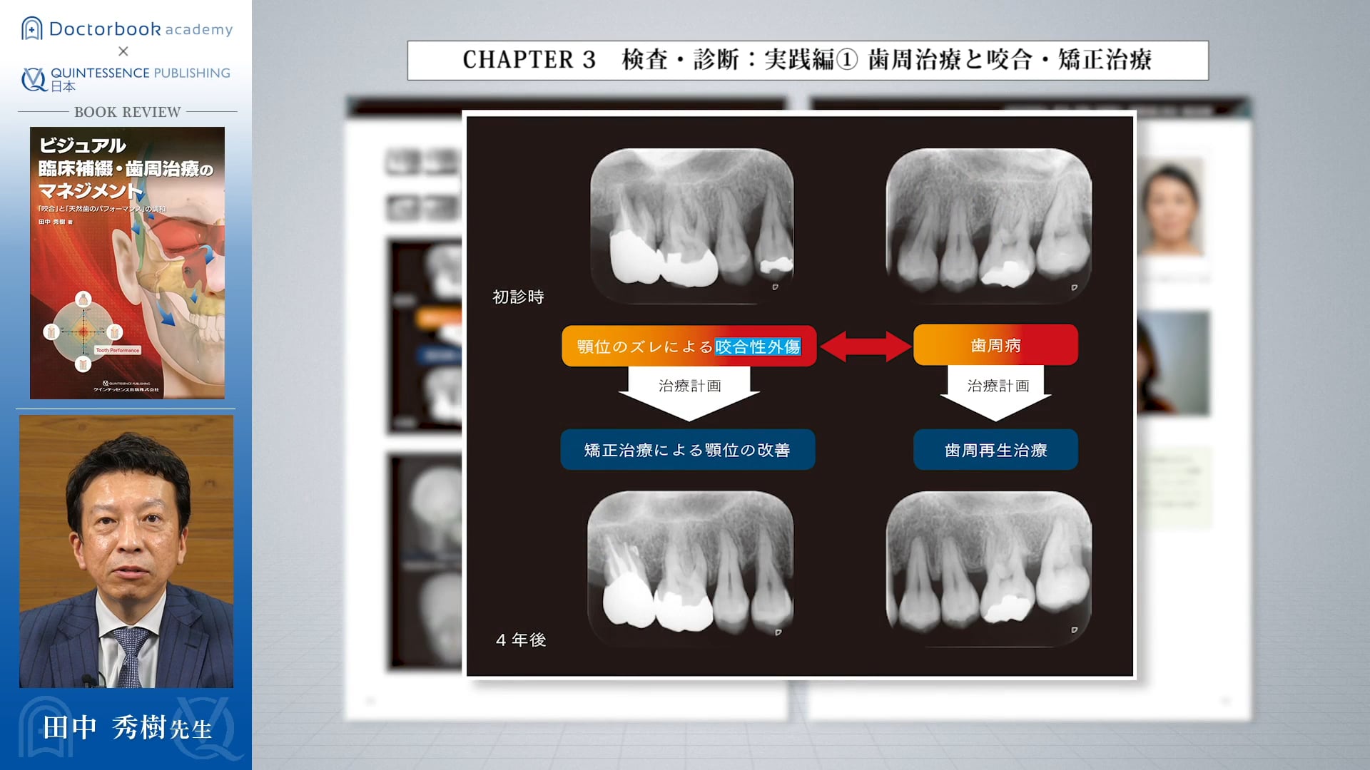 【Book Rev.】ビジュアル 臨床補綴・歯周治療のマネジメント