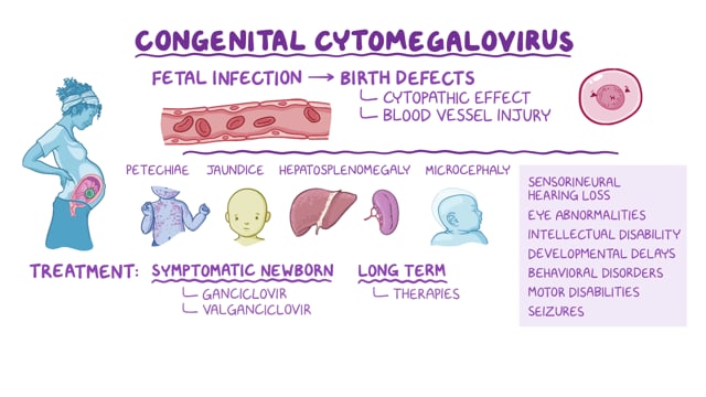 child with congenital cmv