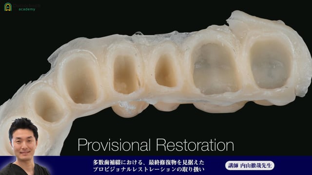  ⑪多数歯補綴における、最終修復物を見据えたプロビジョナルレストレーションの取り扱い