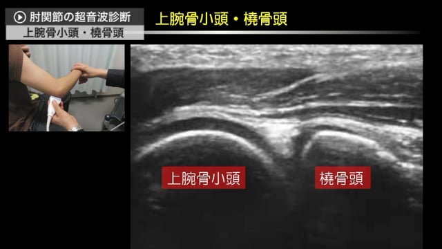 肘関節の超音波診断_2：肘頭・尺骨神経・上腕骨小頭・鉤突起・鉤突窩 編