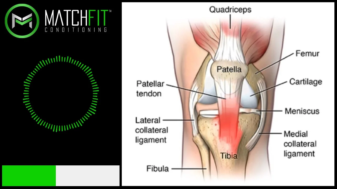 PATELLAR TENDINOPATHY