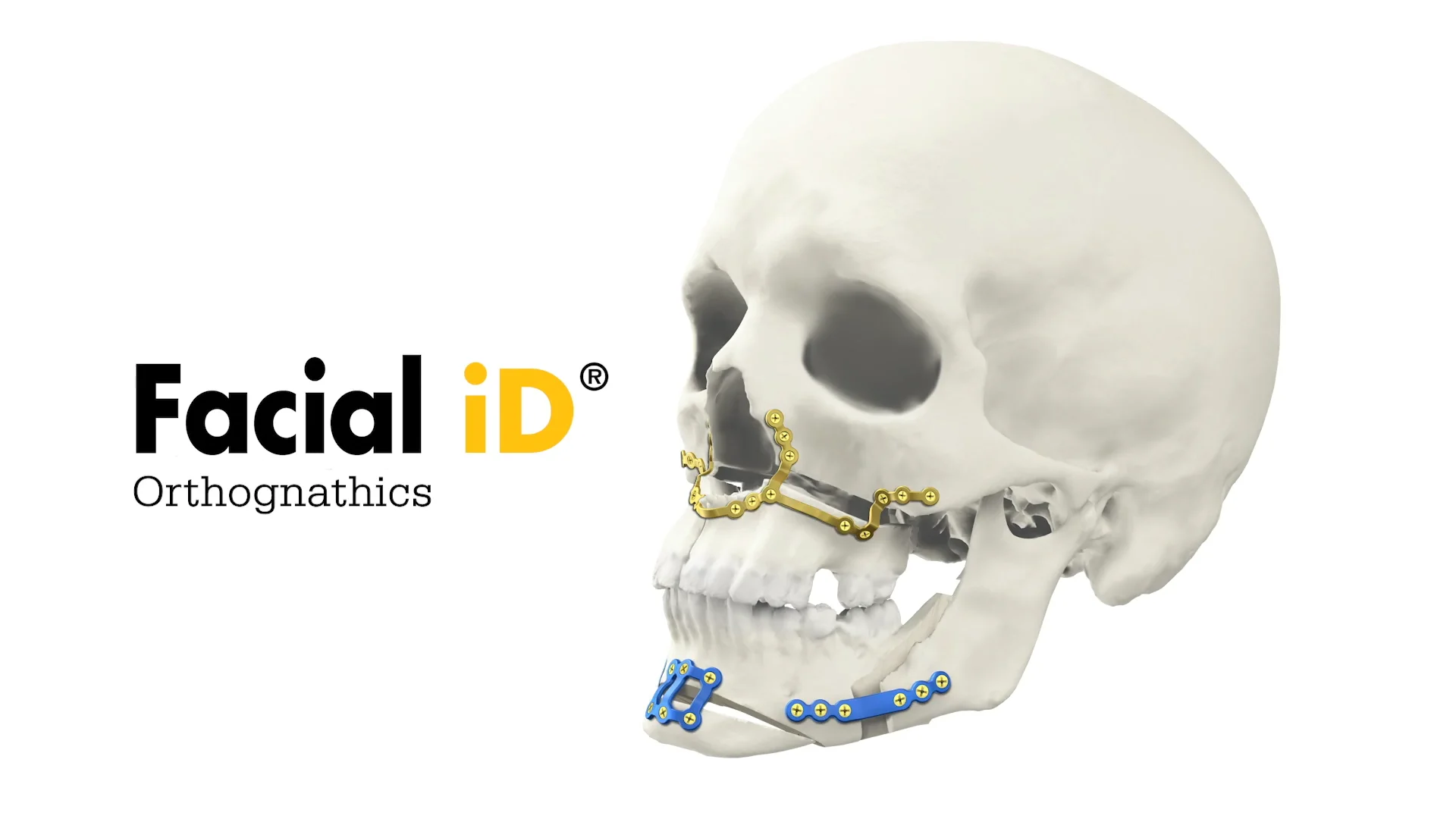 Facial iD