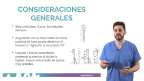 Fijadores externos