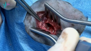 Osteotomía ventral de la bulla timpánica en gatos