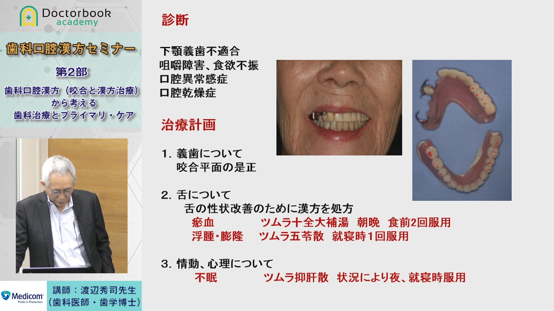 #2 歯科適応となる漢方