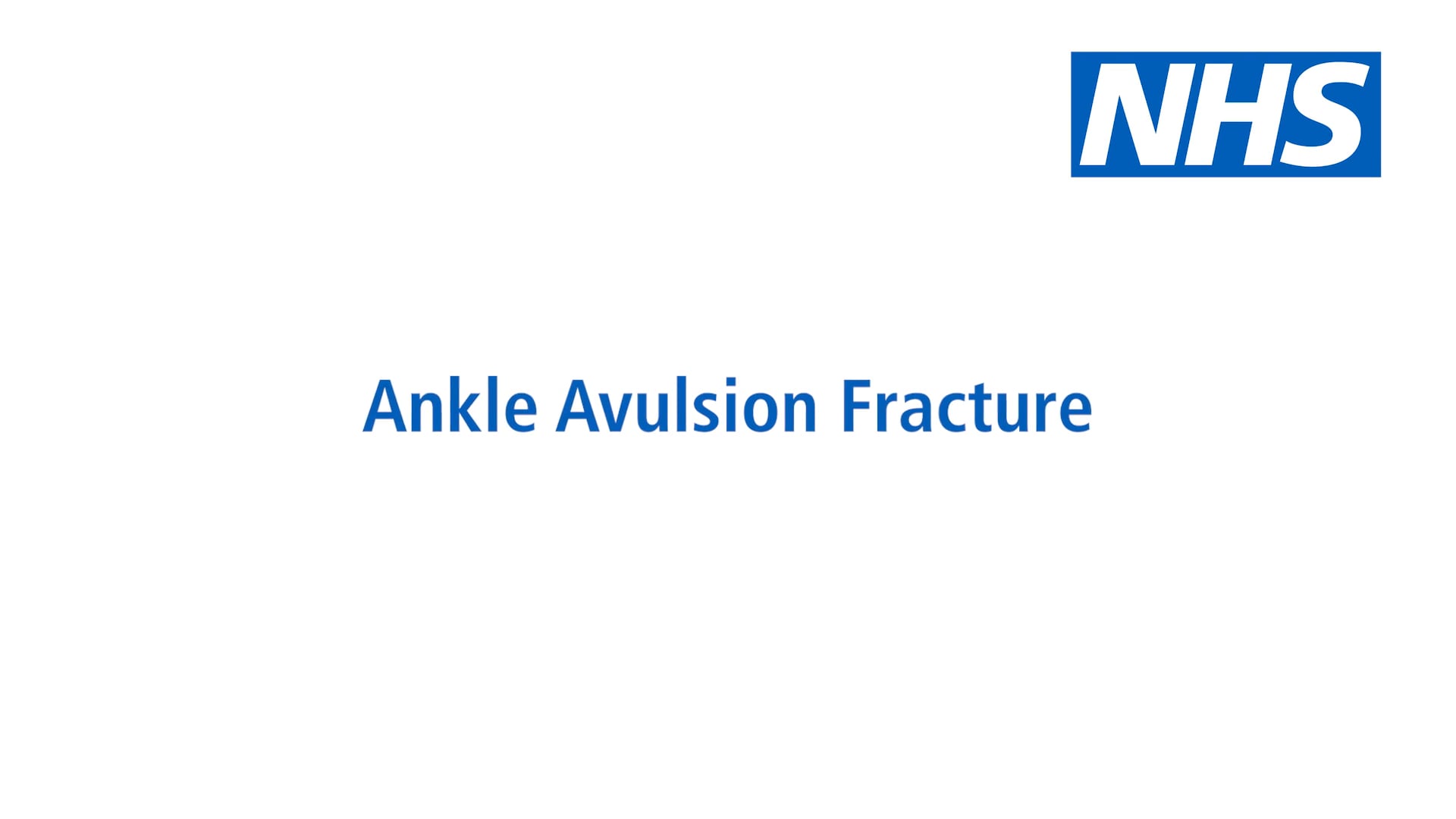 NHS Virtual Fracture Clinic Ankle Avulsion Fracture on Vimeo