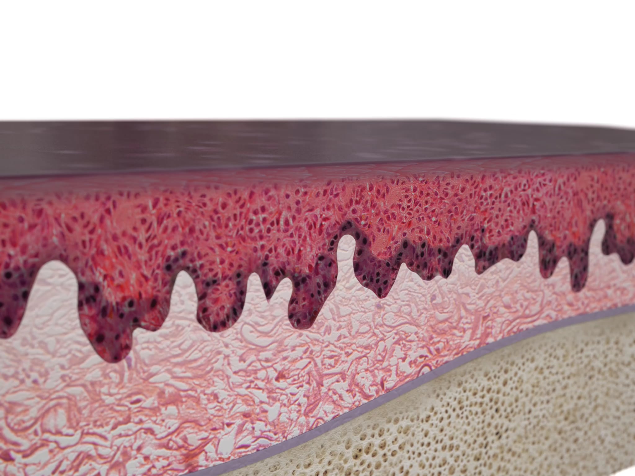 Waterlase Gum Depigmentation