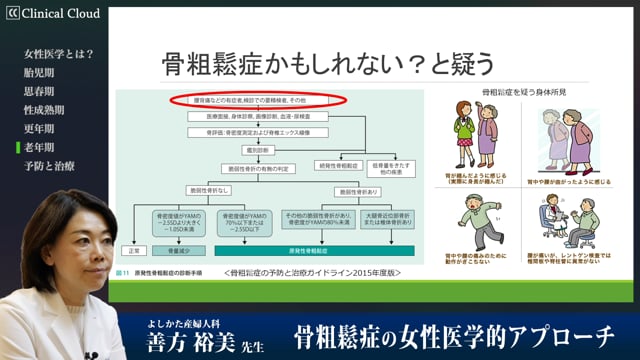 骨粗鬆症の女性医学的アプローチ Part2