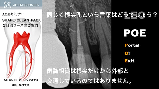 AO エンドセミナー SCP2dayコースダイジェスト