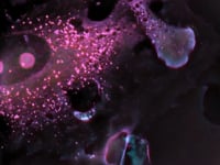 Amazing mesenchymal stem cell