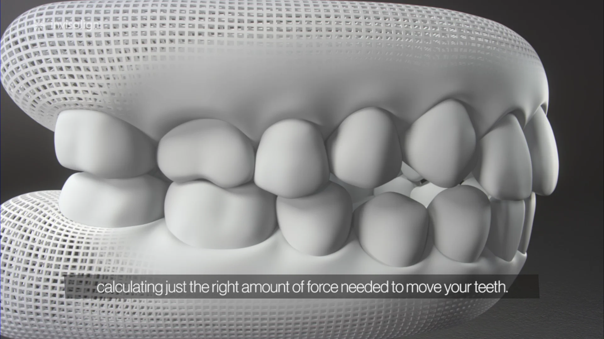 How Invisalign Works on Vimeo