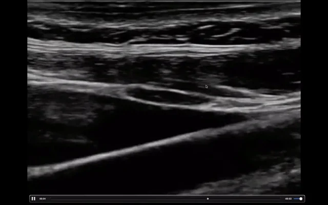 5 Minute Sono - Core Ultrasound