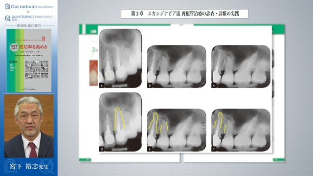 初回限定お試し価格】 再根管治療の成功率を高めるスカンジナビア