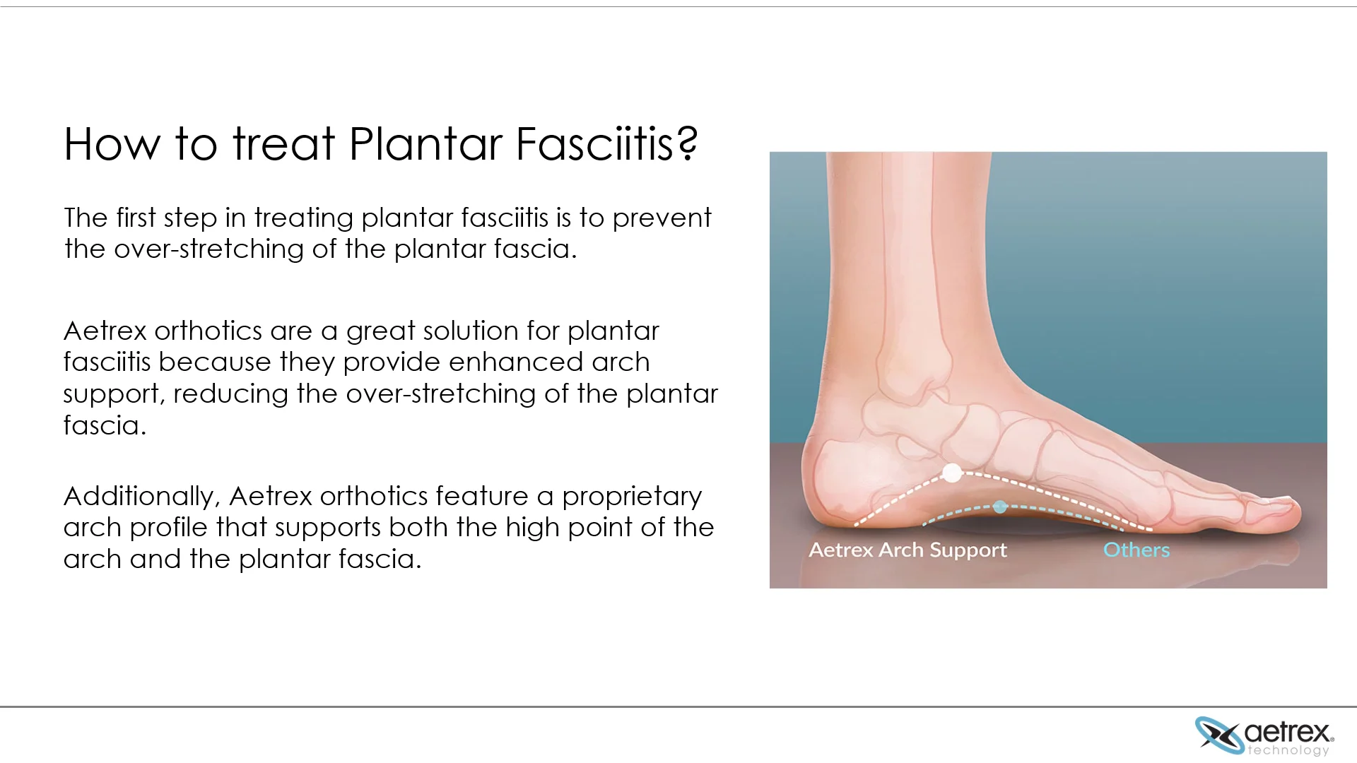 How to Treat Plantar Fasciitis