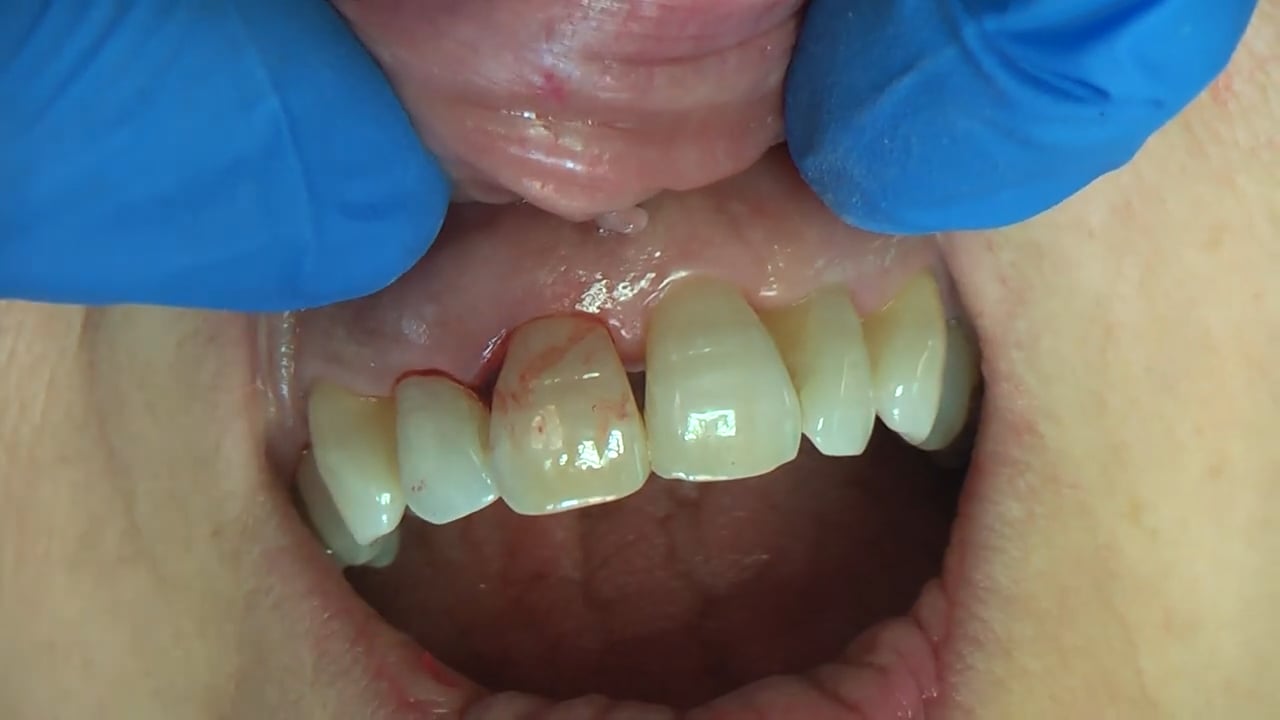 DENTISTA ESPECIALISTA INTEGRAL PERIODONCIA E IMPLANTES VALLADOLID CLINICA DENTAL DOCTORES REY