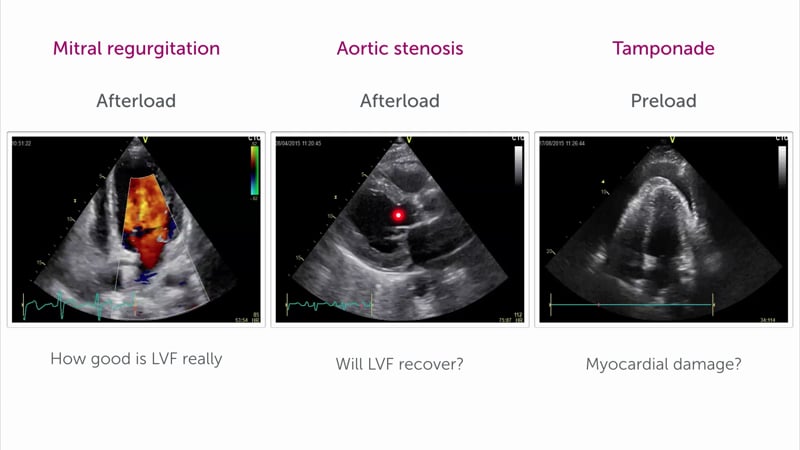 Which factors influence the heart's function?