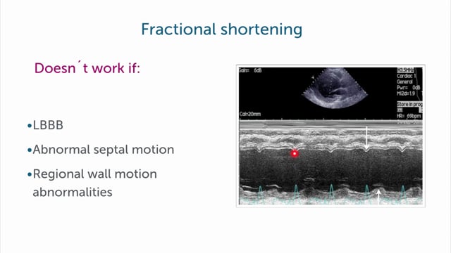 What are limitations of fractional shortening?