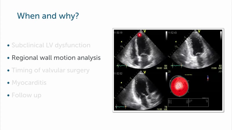 In which cases can I benefit from speckle tracking?