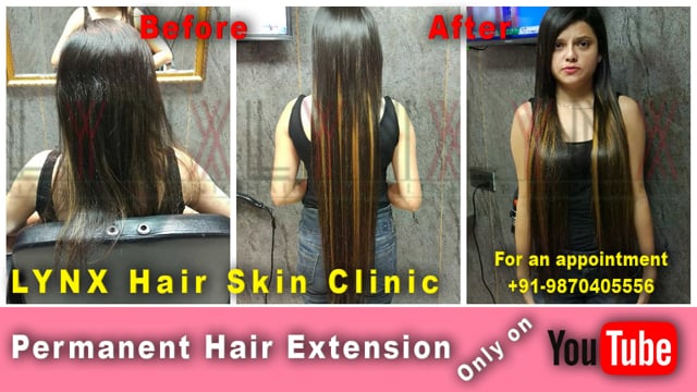 Long Highlighted Hair Extension in Delhi & Gurgaon | Call @ +91-7298877772  in LYNX Hair Skin Clinic on Vimeo