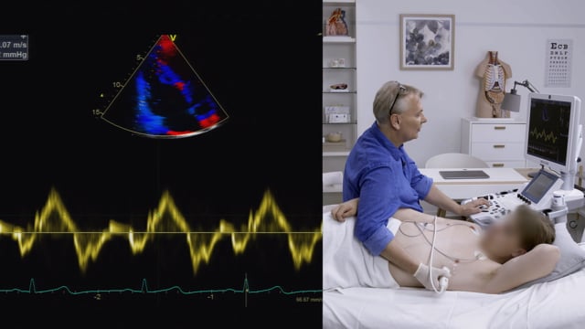 How can I use tissue Doppler to assess RV function?