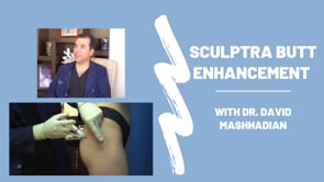 Sculptra Butt Enhancement Procedure Questions with Dr. Mashhadian