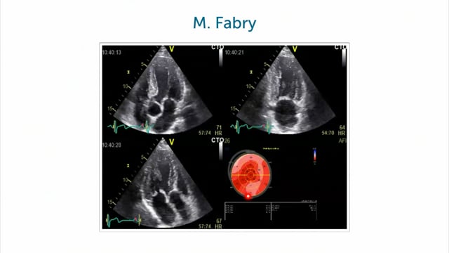 What is M. Fabry?