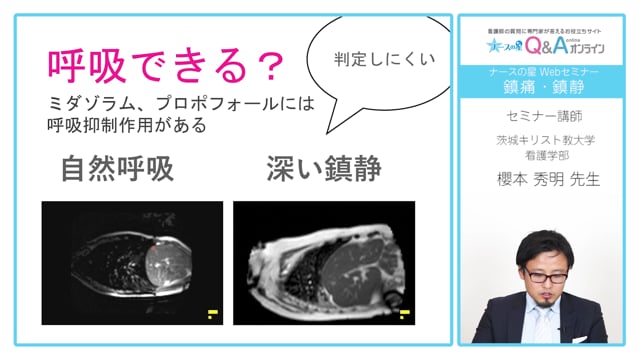 基礎から学ぶ鎮痛・鎮静の管理