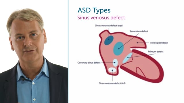 How many types of ASD do we know?