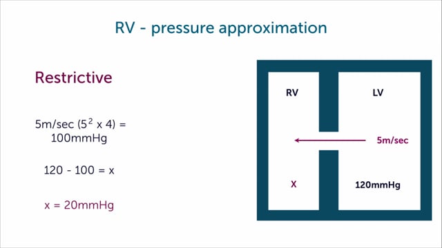 How to assess RV pressure?