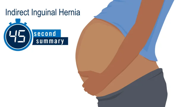 Inguinal Hernias (for Parents)