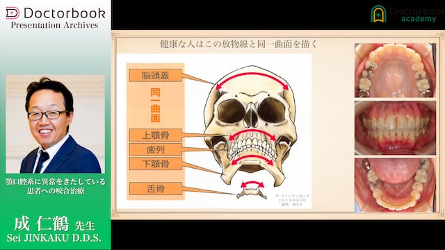 顎口腔系に異常をきたしている患者への咬合治療 | Doctorbook academy 