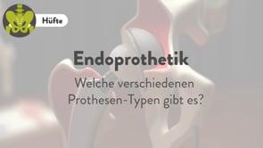 Knstliches Hftgelenk | Deutsches Zentrum fr Orthopdie