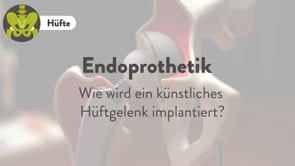 knstliche gebrmutter lamm Paomi Plsch Aufklrungsmodell Gebrmutter klein I Ladyplanet