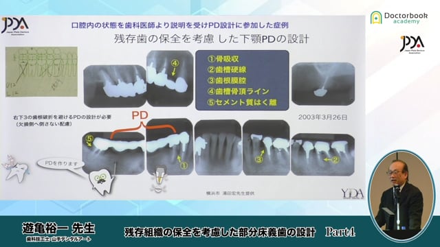 #4 PD設計に参加した症例