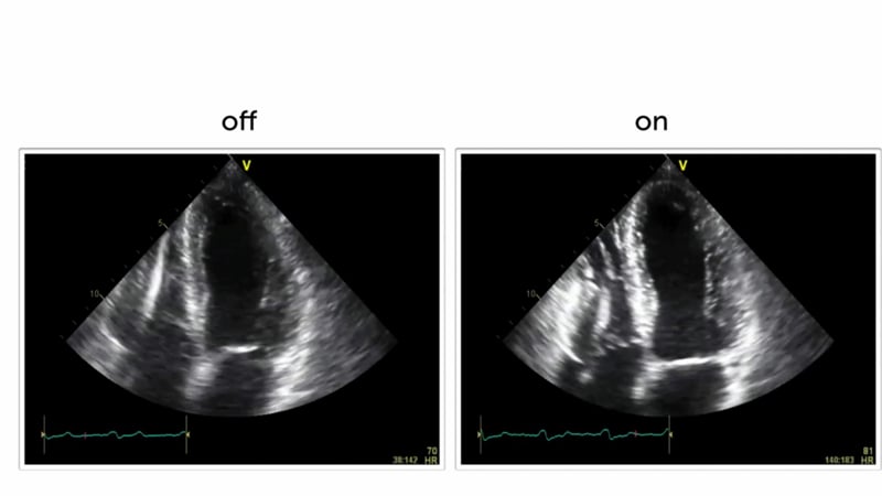 CRT and follow-up: is there anything to check?