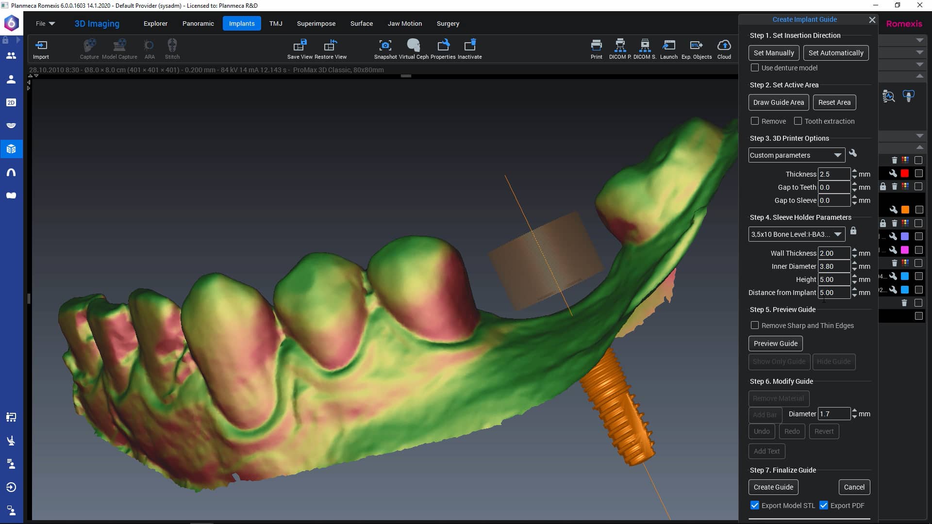How to Define your own sleeve parameters for guide designing in